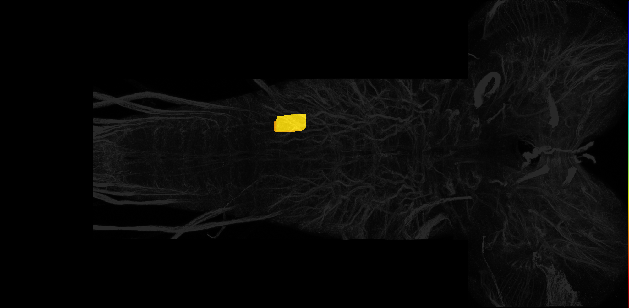 left centrolateral neuropil of A2 on L3 CNS template, Wood2018