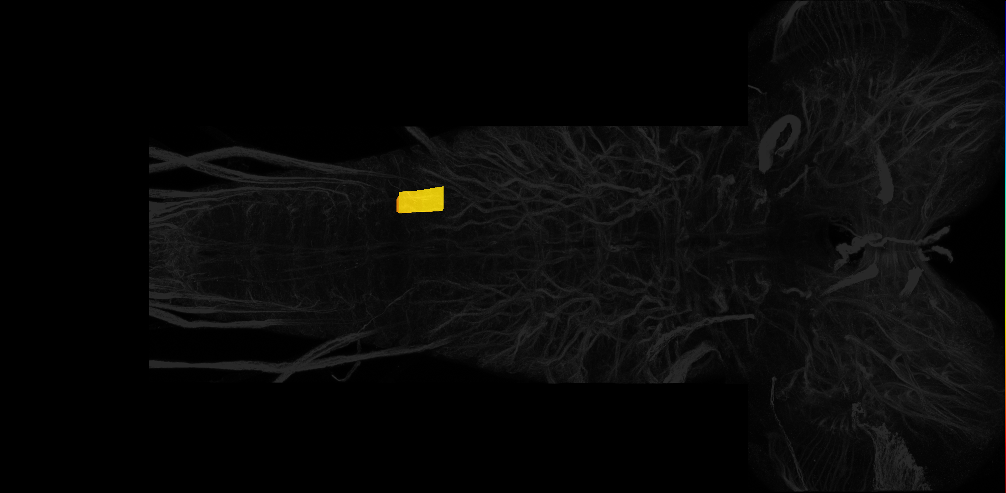 left centrolateral neuropil of A3 on L3 CNS template, Wood2018