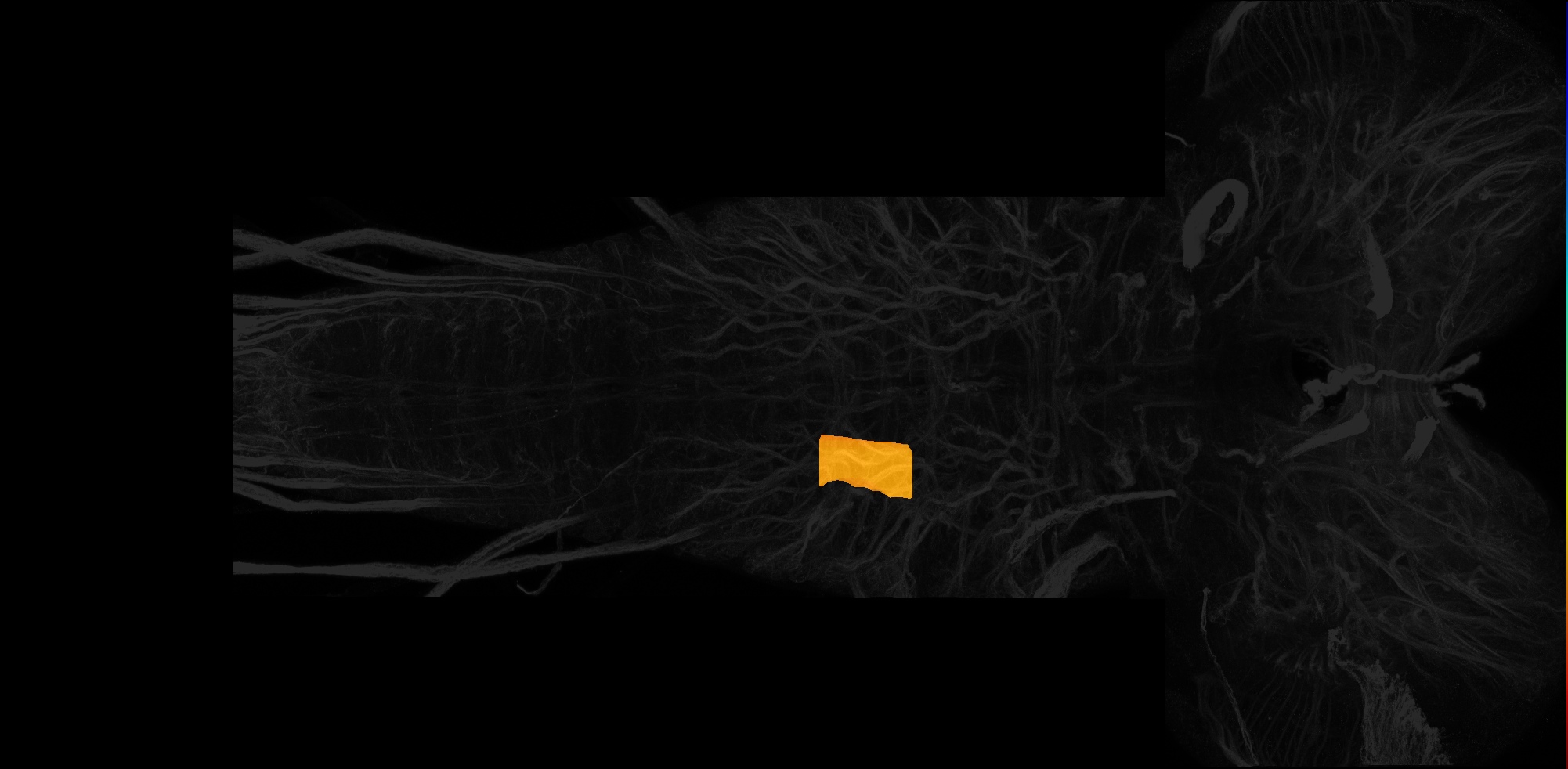 right ventrolateral neuropil of T3 on L3 CNS template, Wood2018