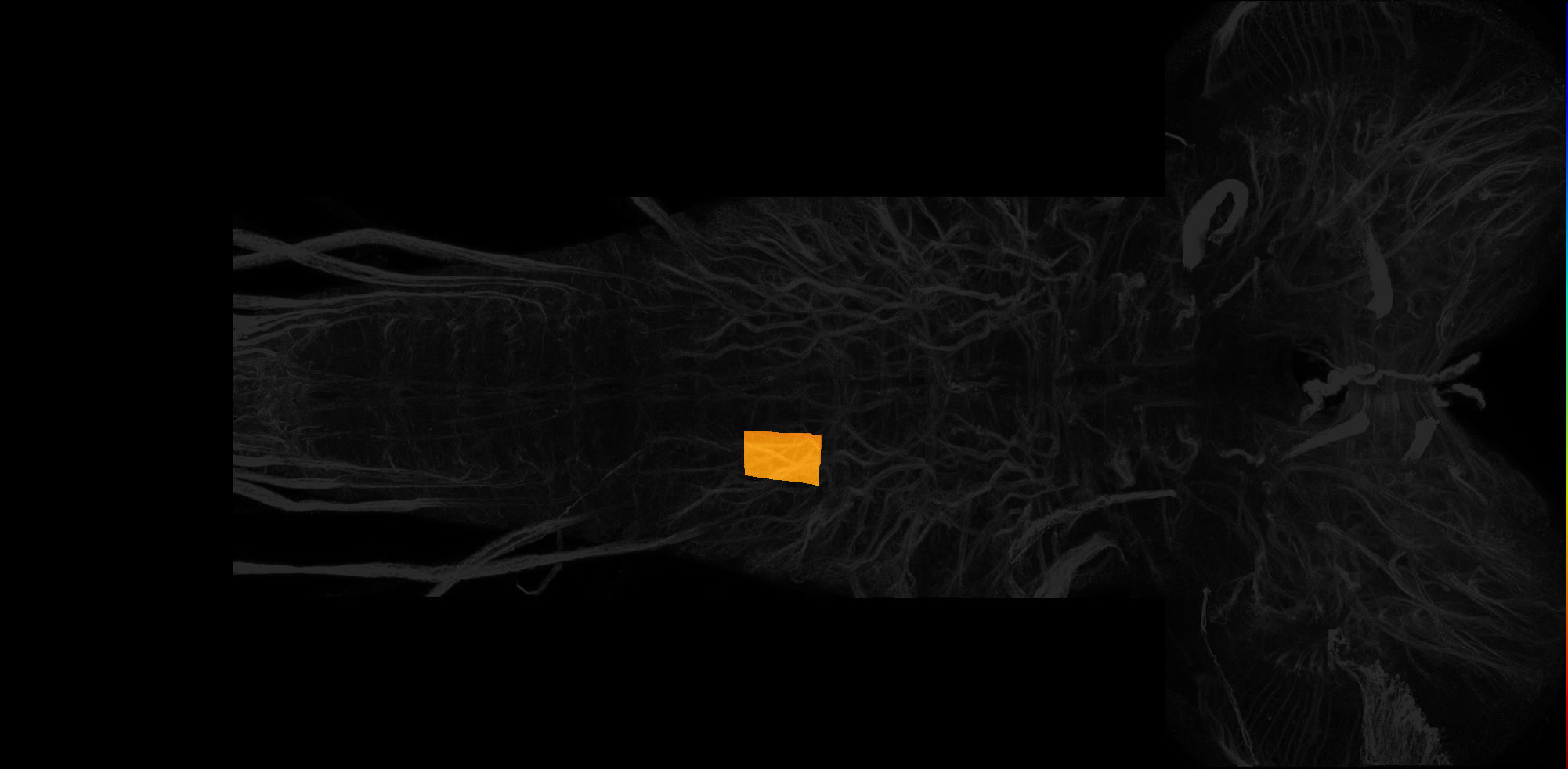 right ventrolateral neuropil of A1 on L3 CNS template, Wood2018