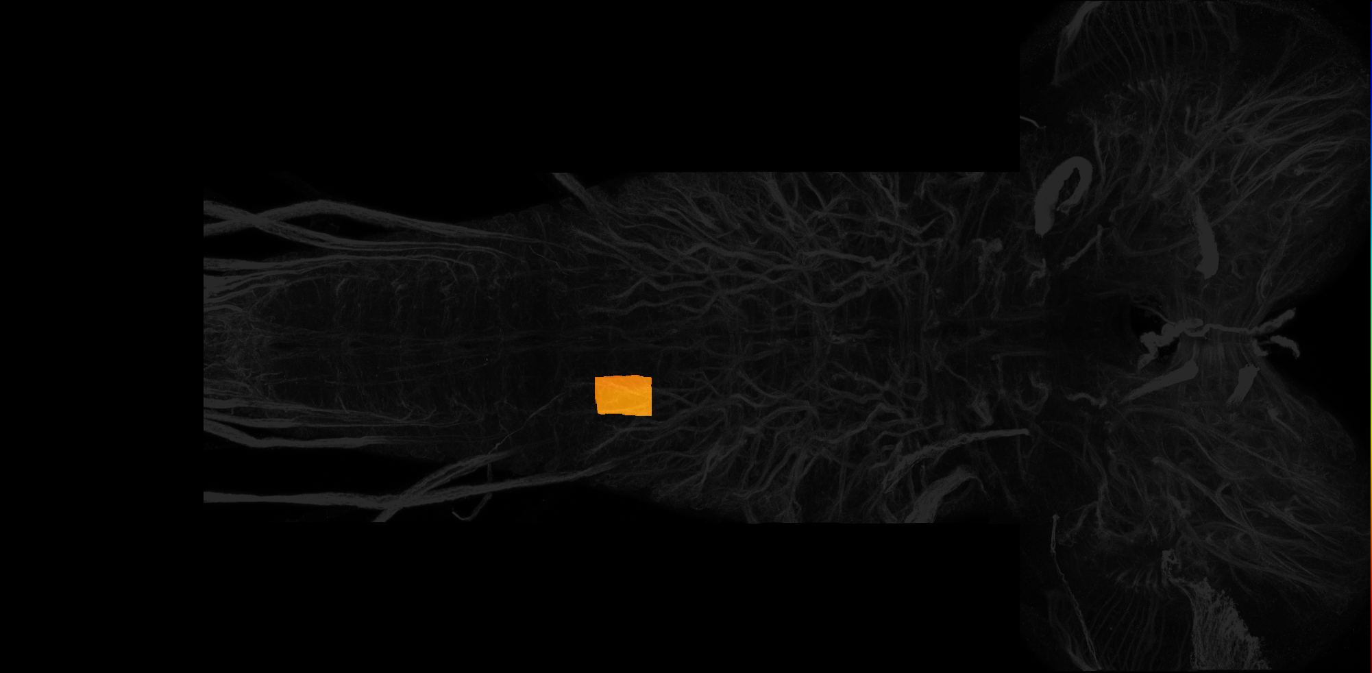 right ventrolateral neuropil of A2 on L3 CNS template, Wood2018