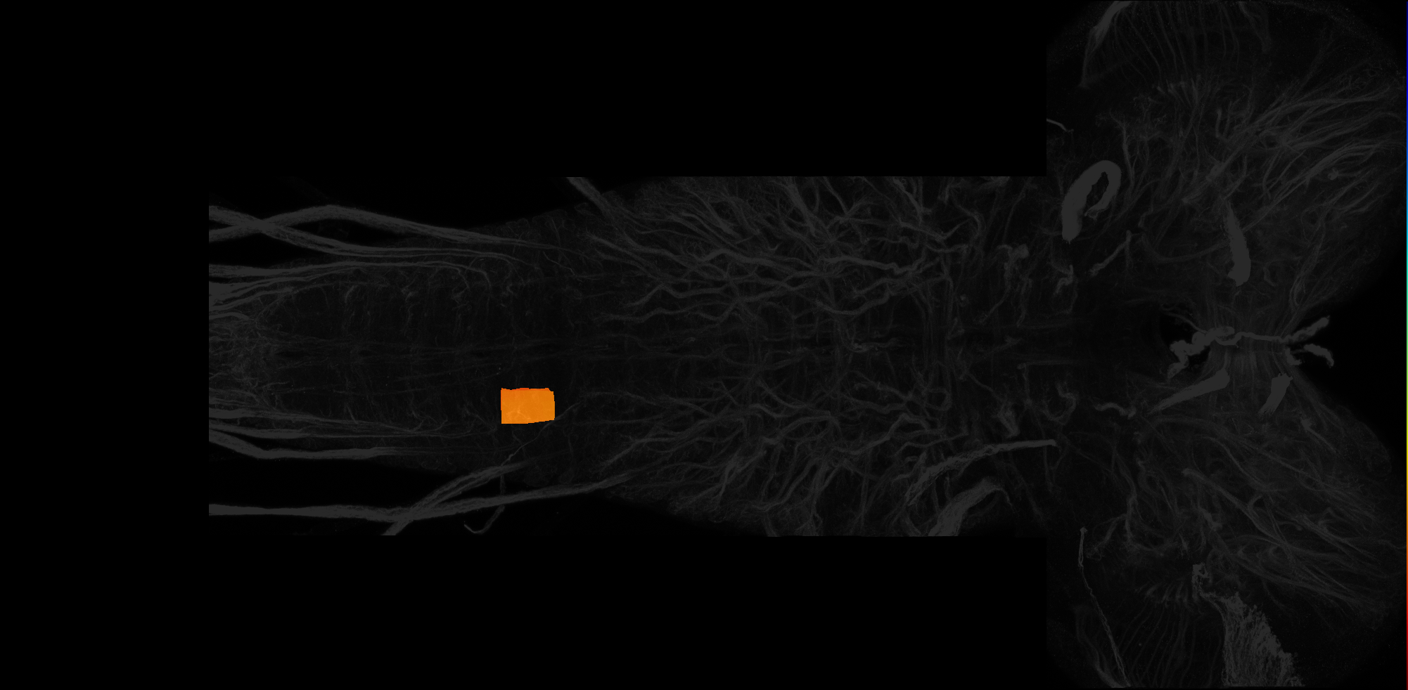 right ventrolateral neuropil of A4 on L3 CNS template, Wood2018