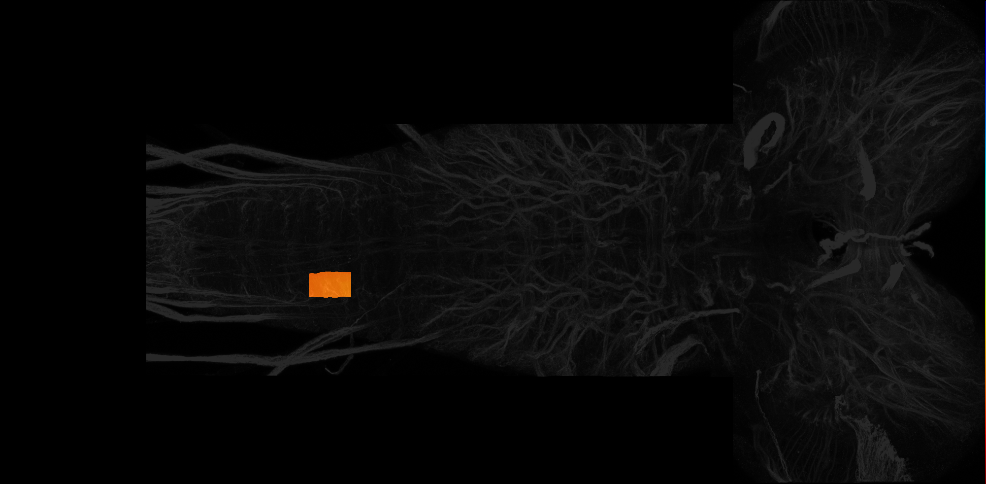 right ventrolateral neuropil of A5 on L3 CNS template, Wood2018