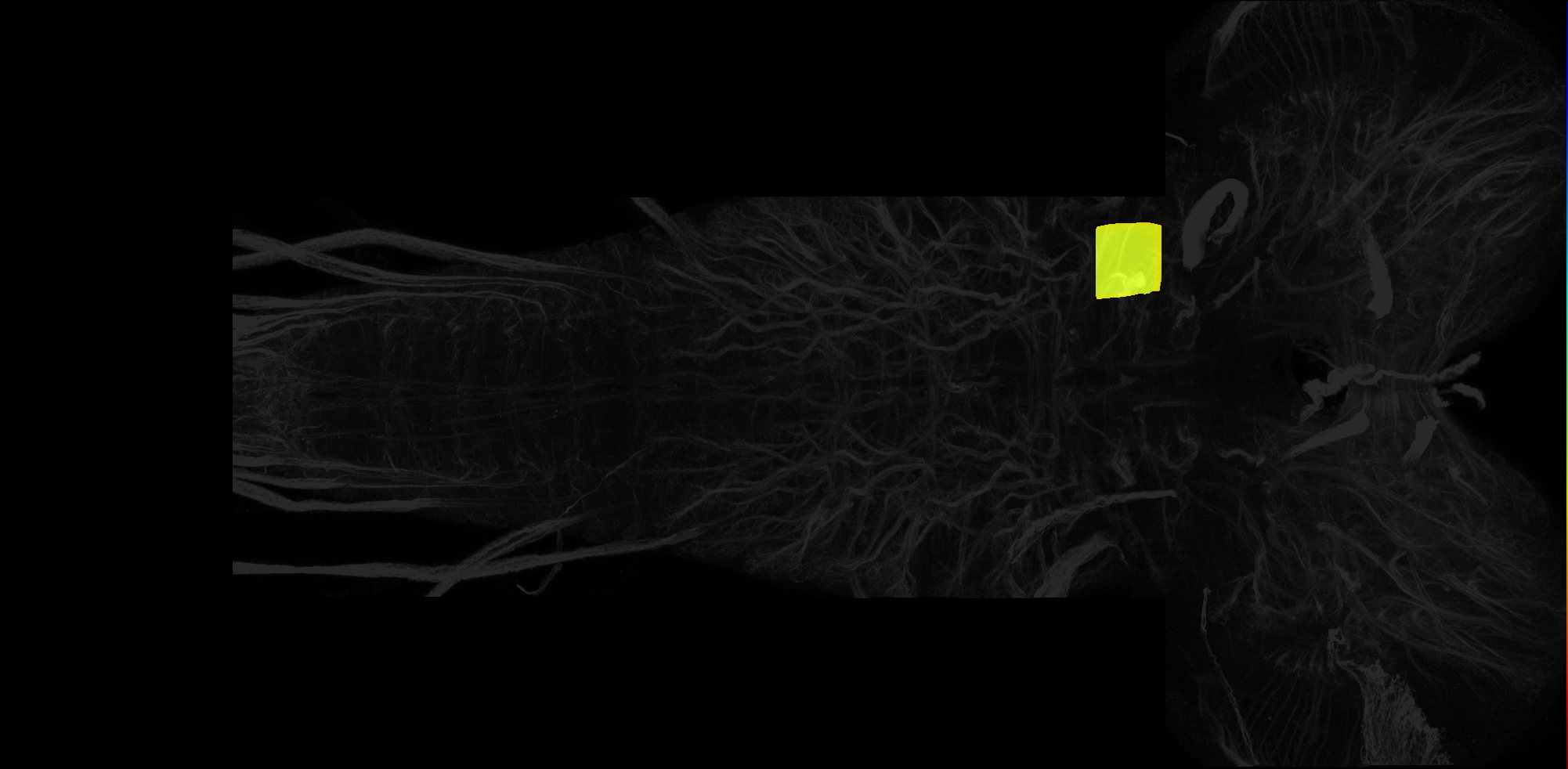 left dorsolateral neuropil of labial segment on L3 CNS template, Wood2018
