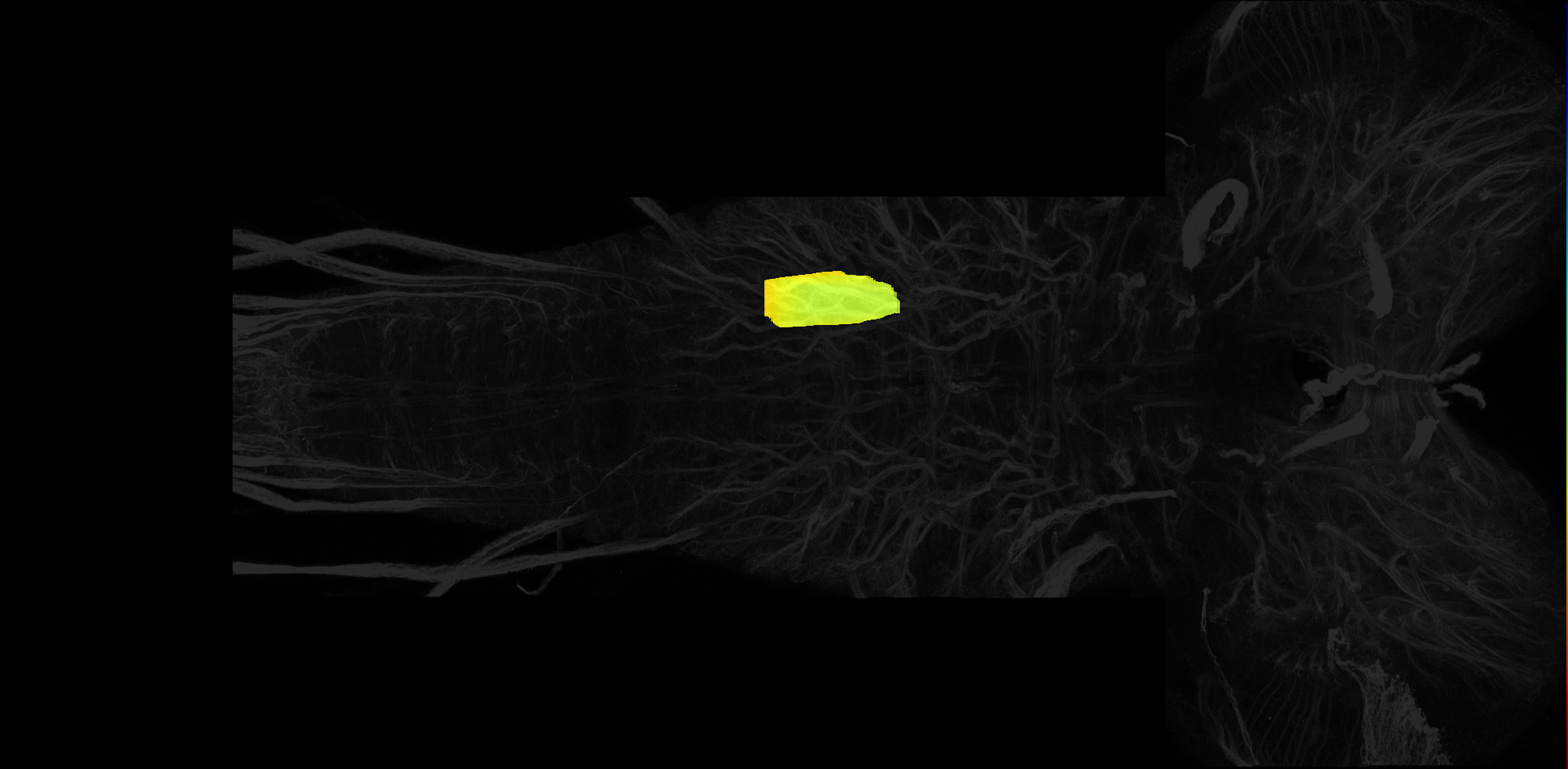 left dorsolateral neuropil of A1 on L3 CNS template, Wood2018