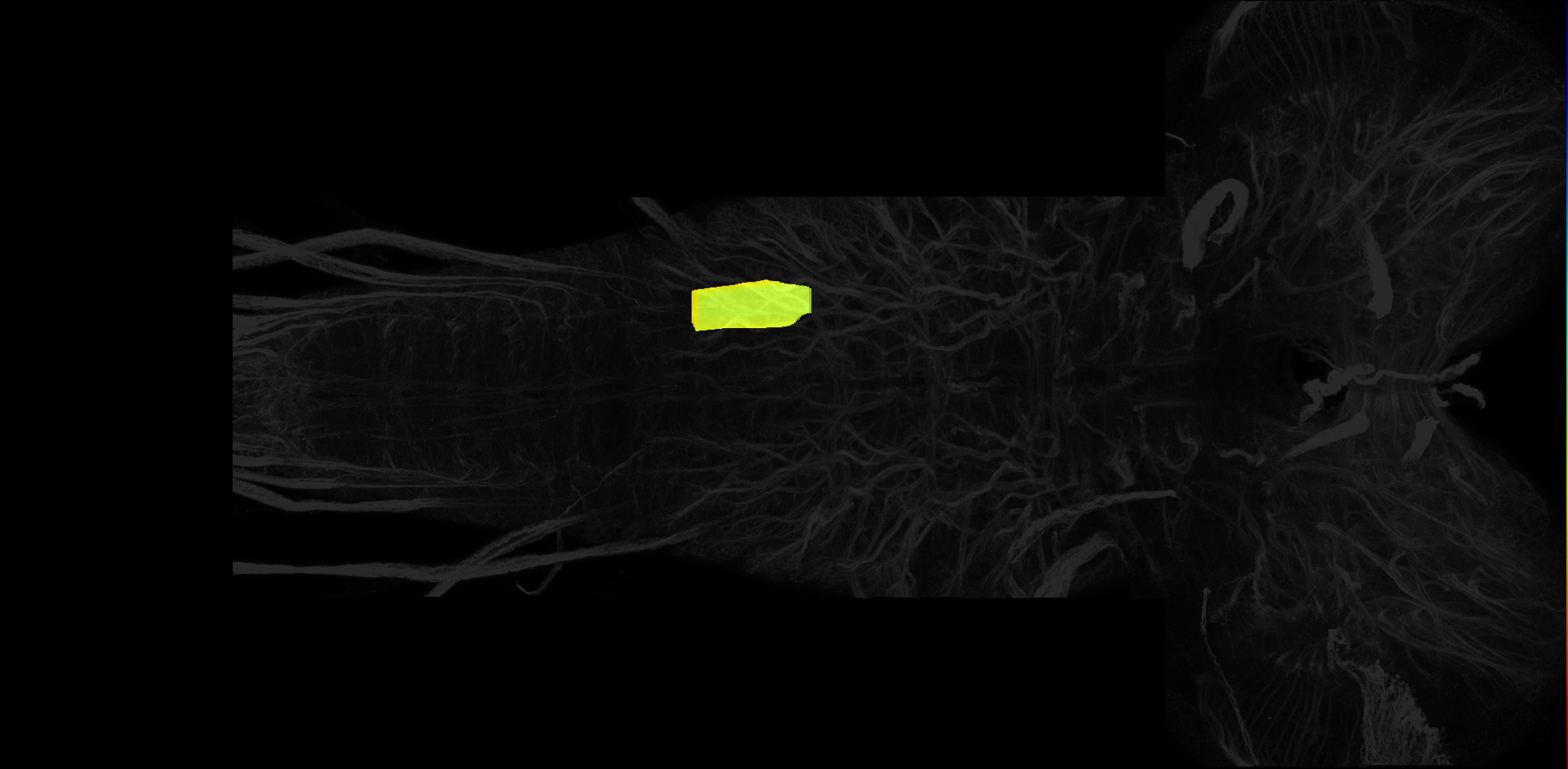 left dorsolateral neuropil of A2 on L3 CNS template, Wood2018