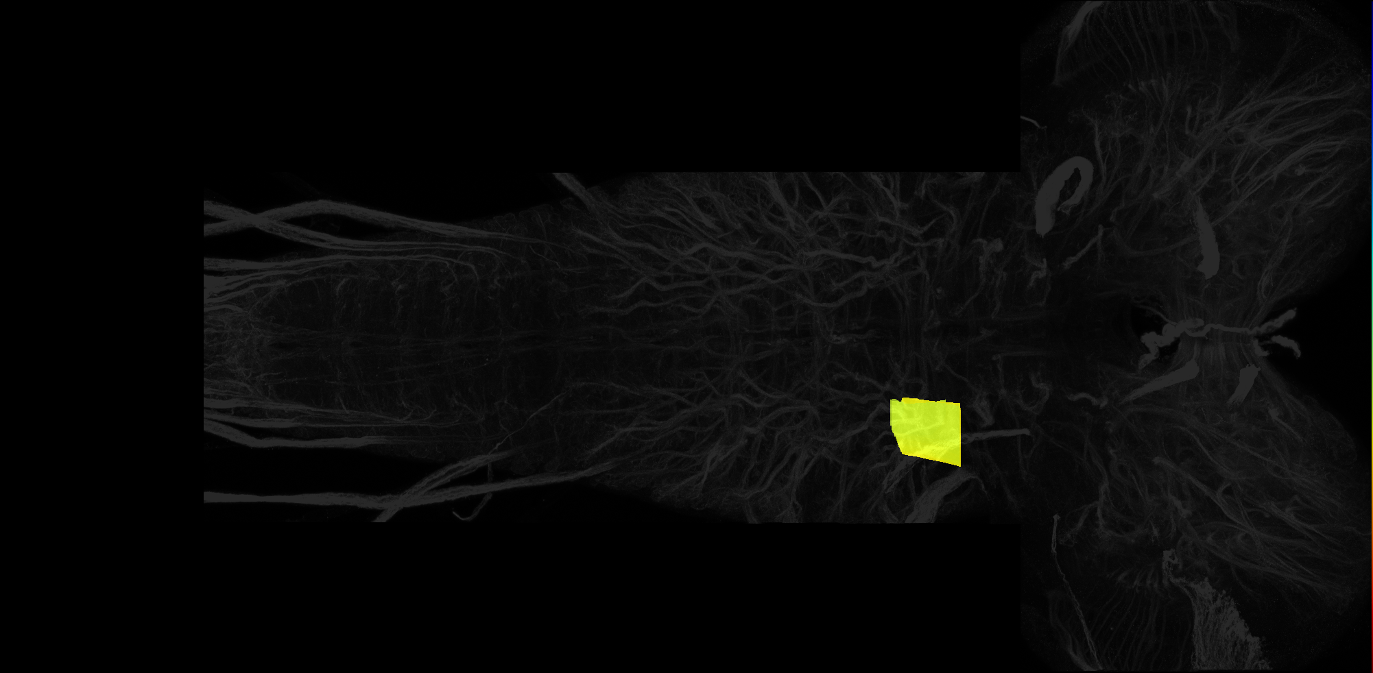 right dorsolateral neuropil of T1 on L3 CNS template, Wood2018
