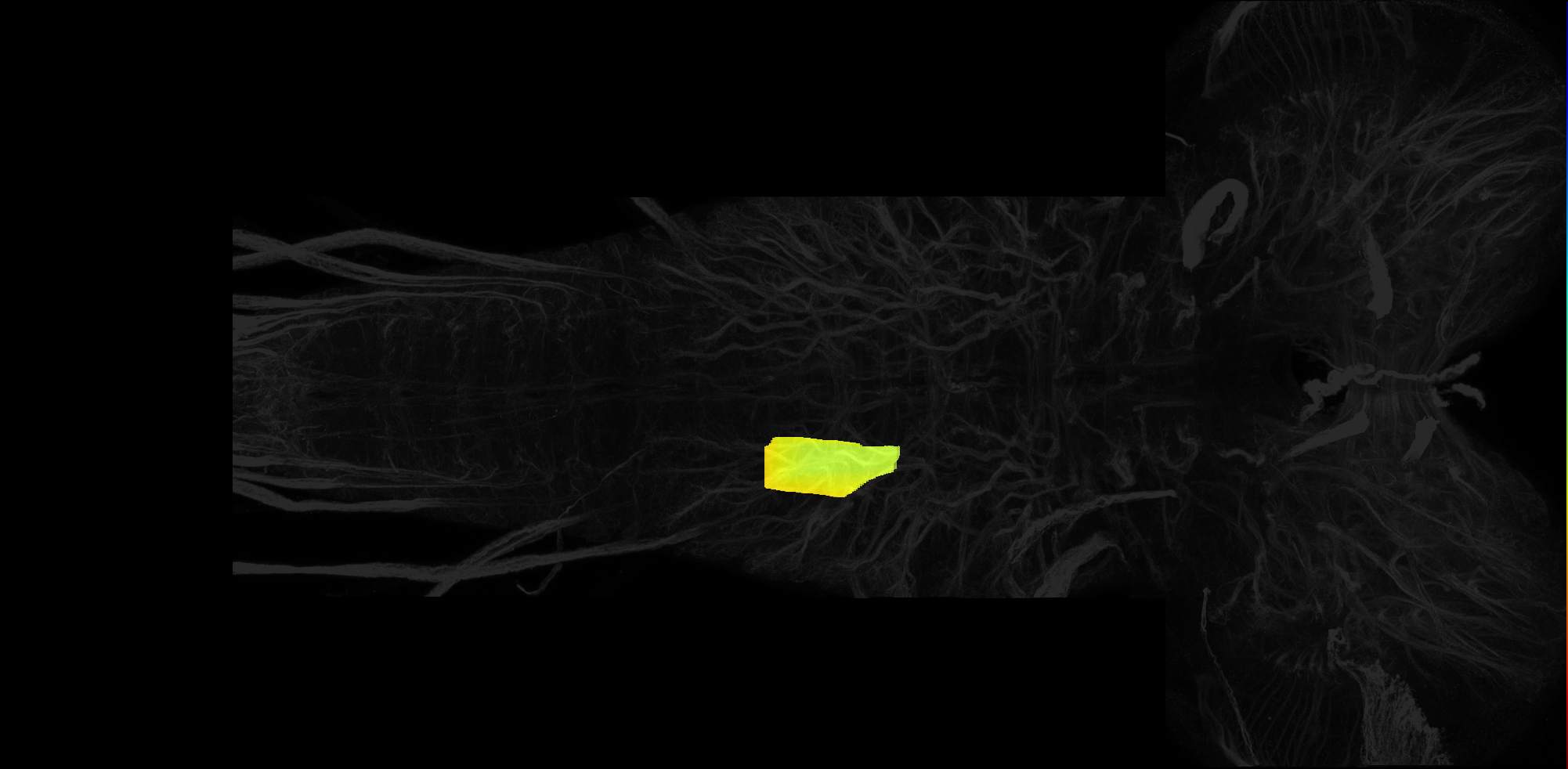 right dorsolateral neuropil of A1 on L3 CNS template, Wood2018