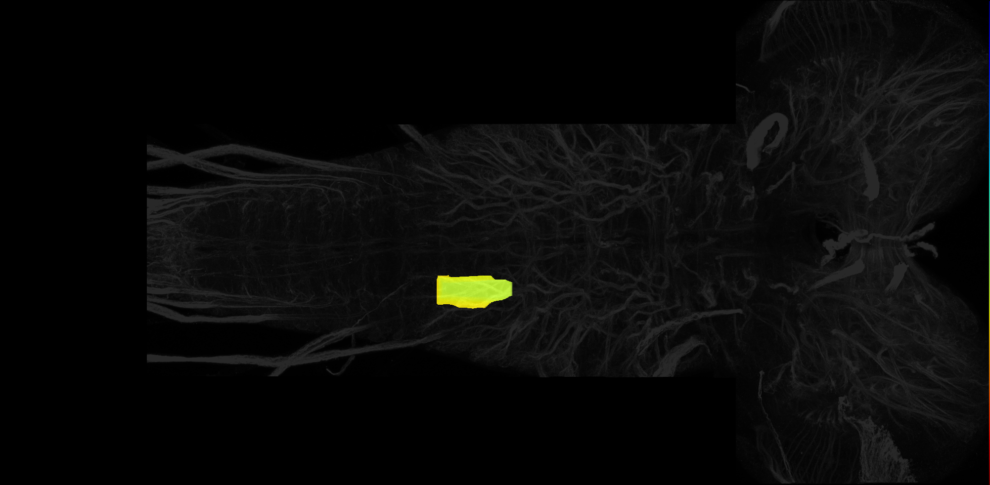 right dorsolateral neuropil of A2 on L3 CNS template, Wood2018