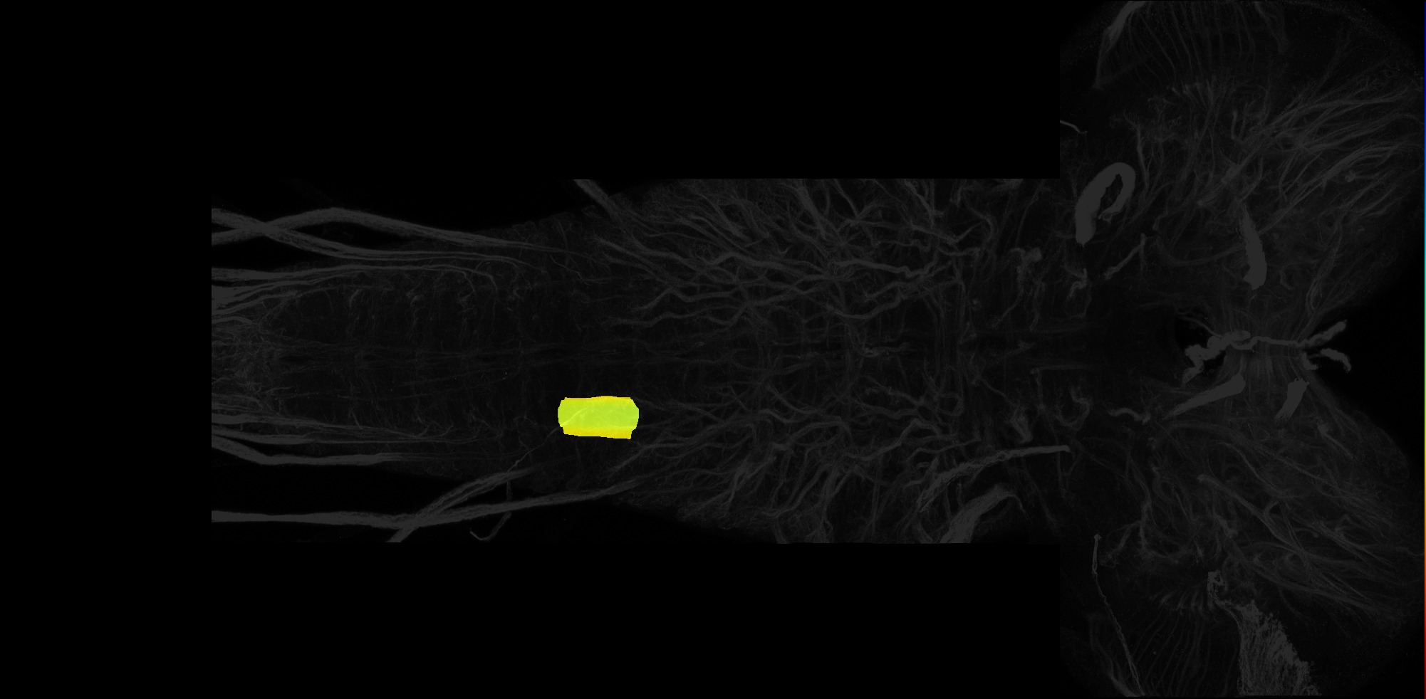 right dorsolateral neuropil of A3 on L3 CNS template, Wood2018