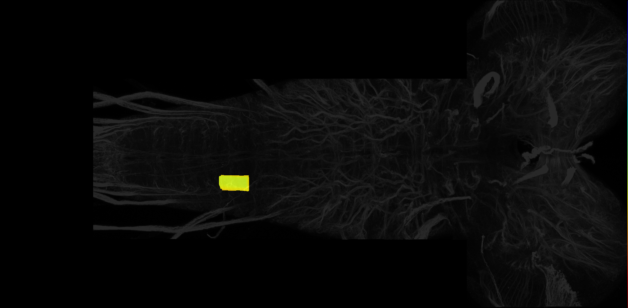right dorsolateral neuropil of A4 on L3 CNS template, Wood2018