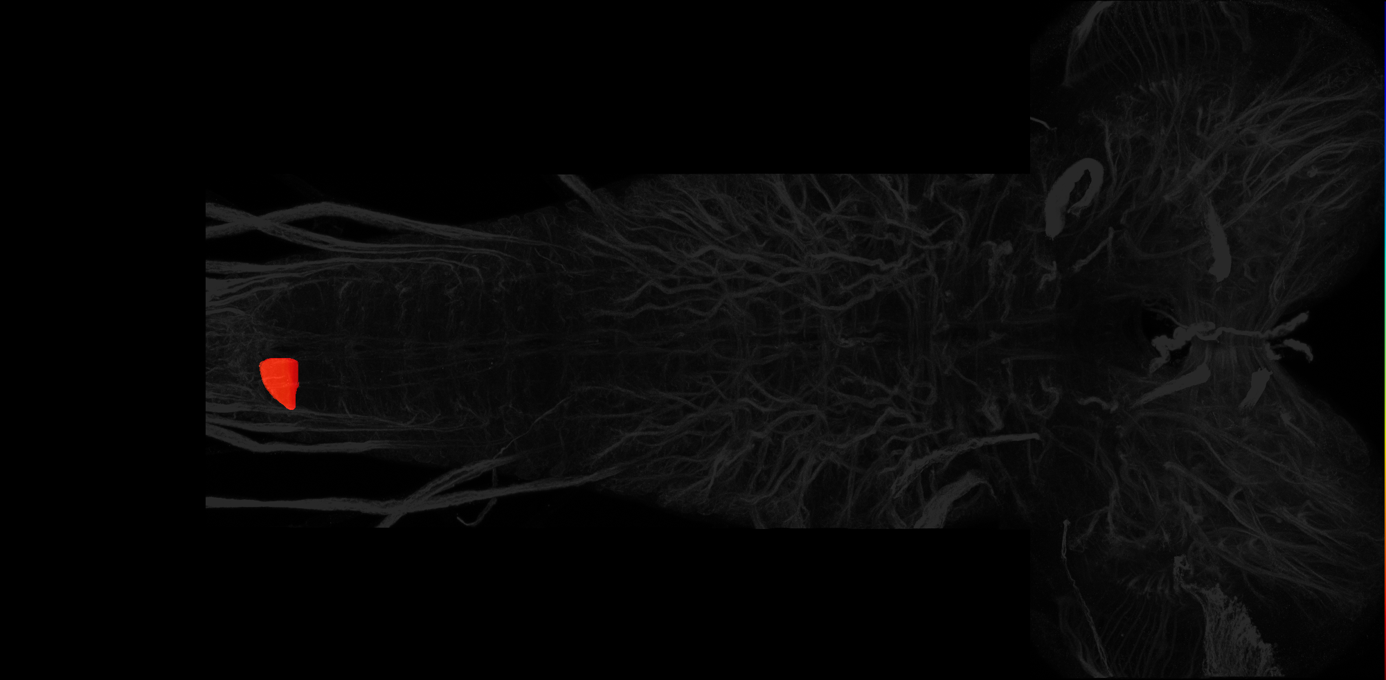 right dorsal neuropil of A9 on L3 CNS template, Wood2018
