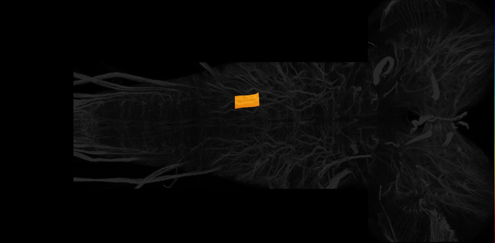 left ventrolateral neuropil of A1 on L3 CNS template, Wood2018