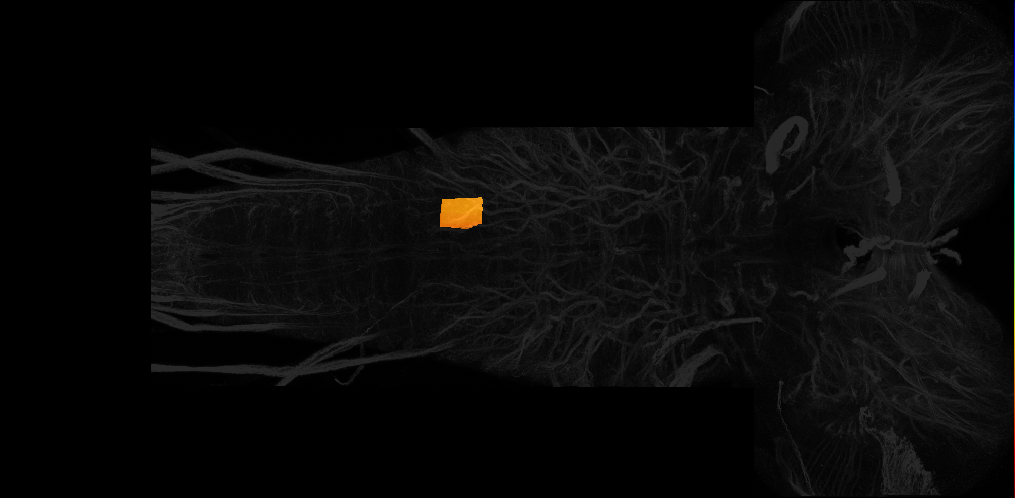 left ventrolateral neuropil of A2 on L3 CNS template, Wood2018