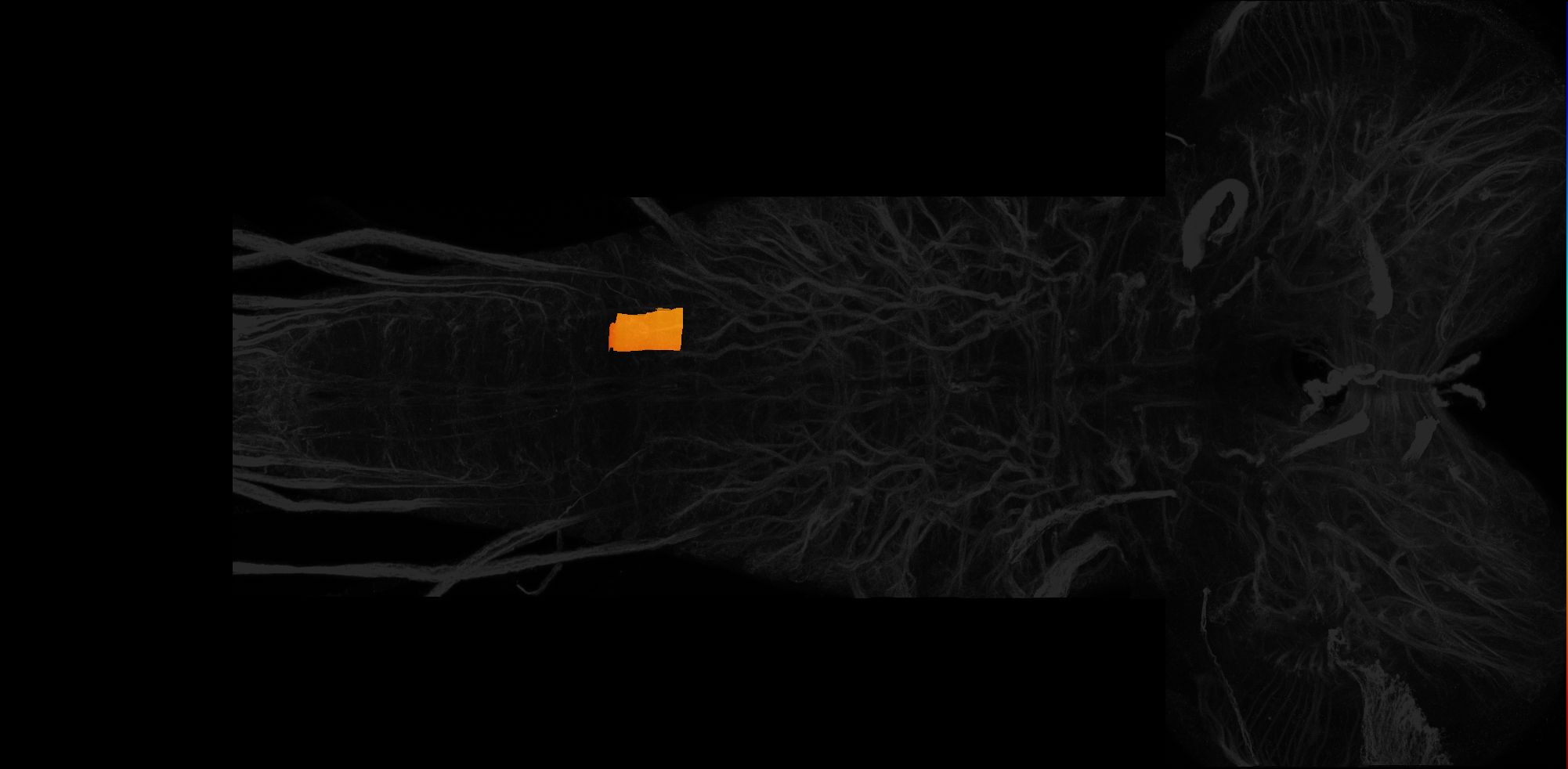 left ventrolateral neuropil of A3 on L3 CNS template, Wood2018