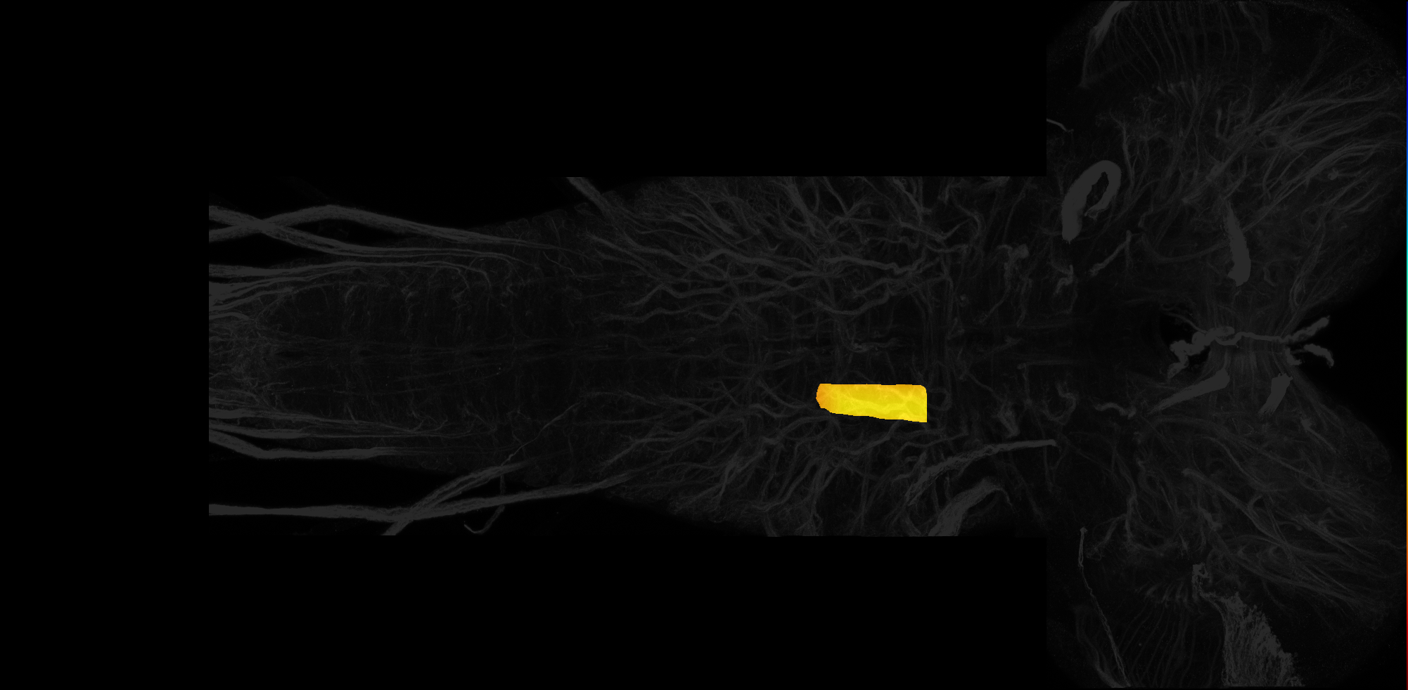 right central neuropil of T2 on L3 CNS template, Wood2018