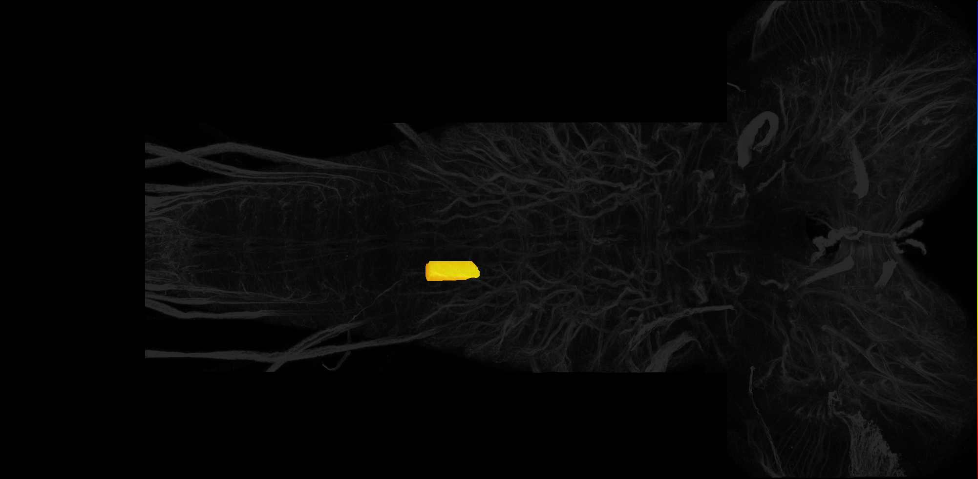 central domain of larval A2 neuromere