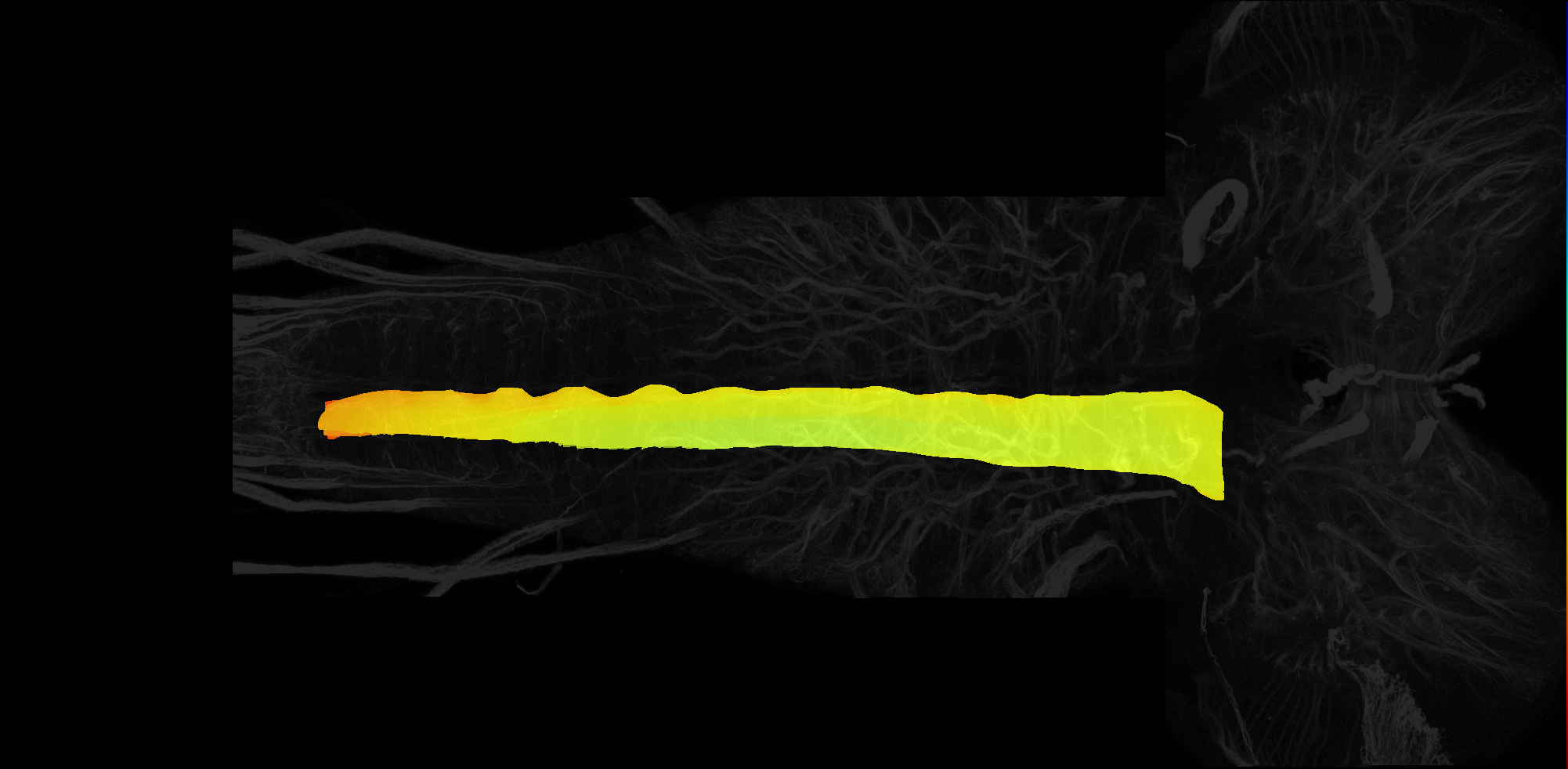 dorsomedial domain of larval central nervous system
