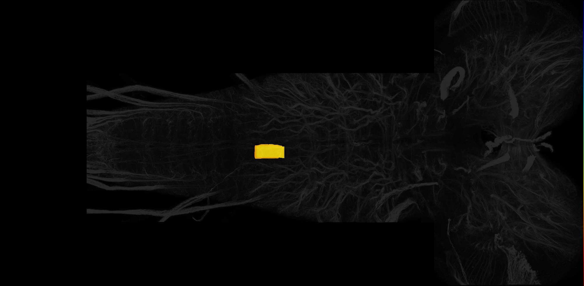centromedial domain of larval A2 neuromere