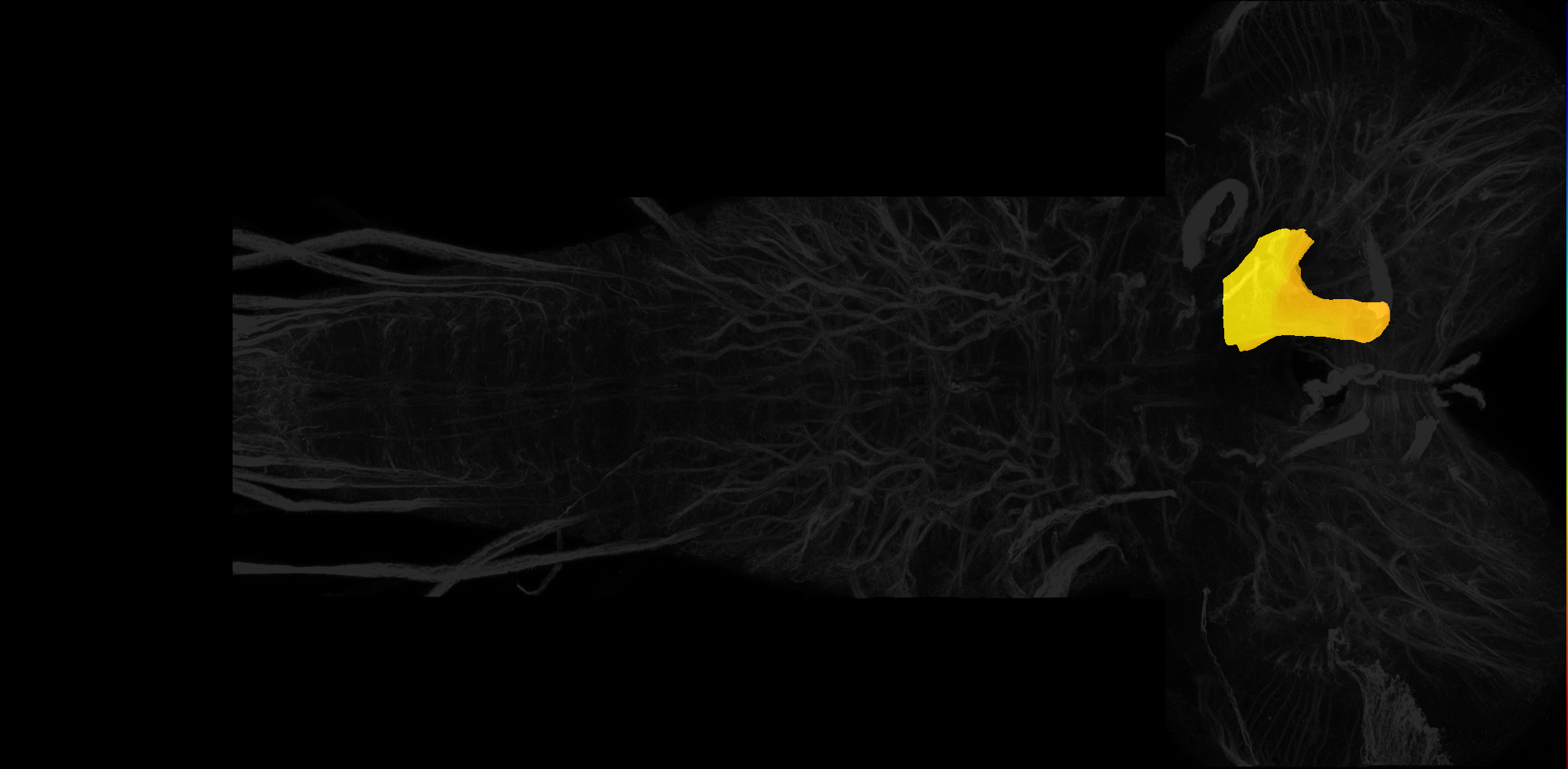 left centromedial neuropil of tritocerebrum on L3 CNS template, Wood2018