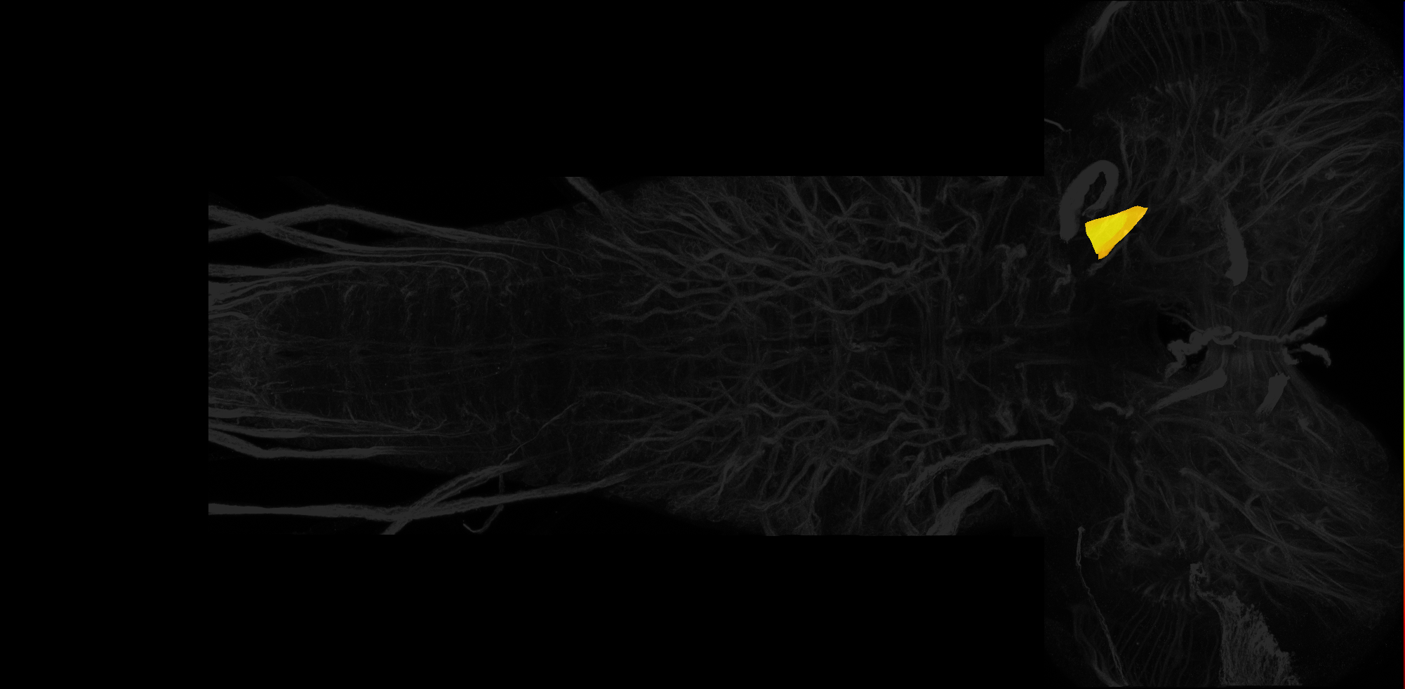 left central neuropil of tritocerebrum on L3 CNS template, Wood2018