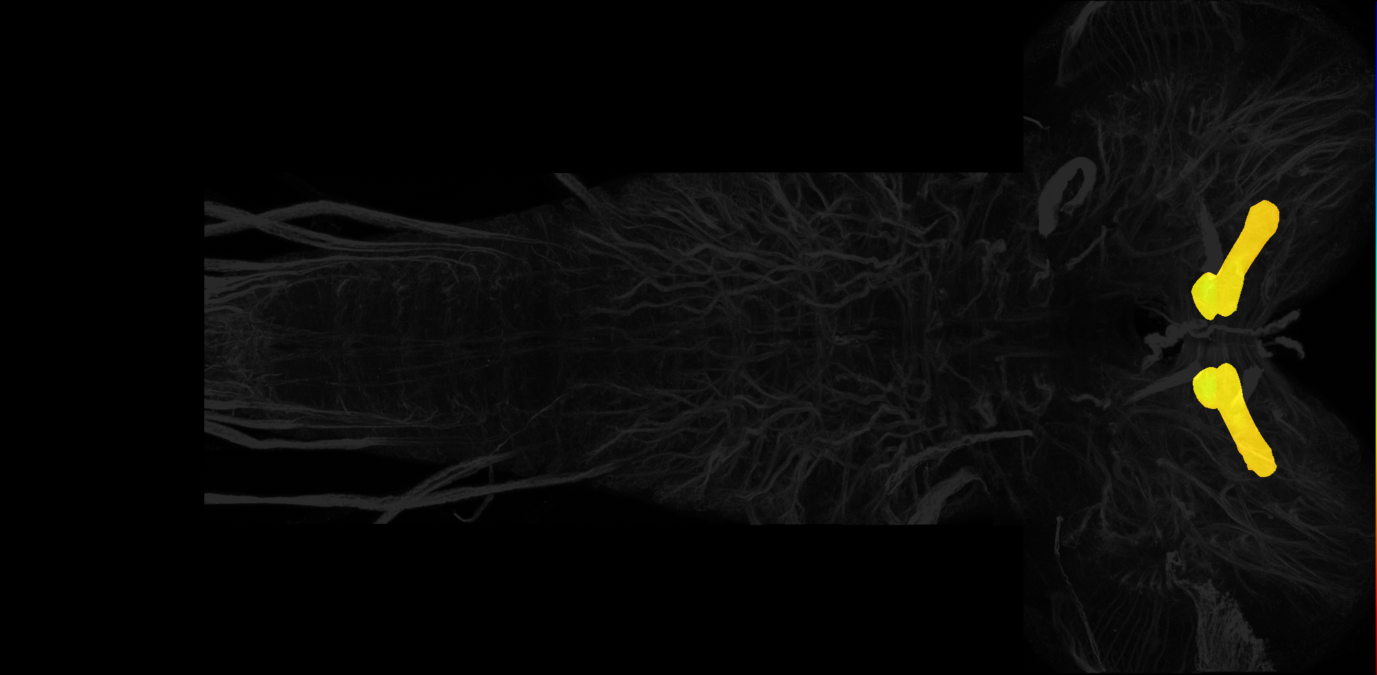 medial lobe of mushroom body on L3 CNS template, Wood2018