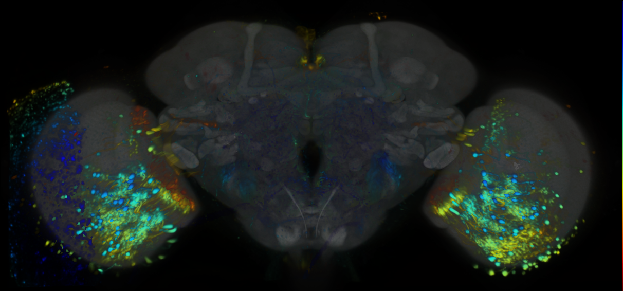 P{VT000460-GAL4} expression pattern
