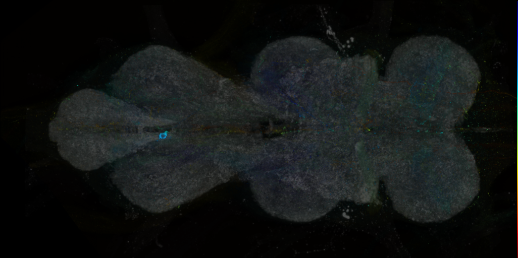 P{VT000460-GAL4} expression pattern