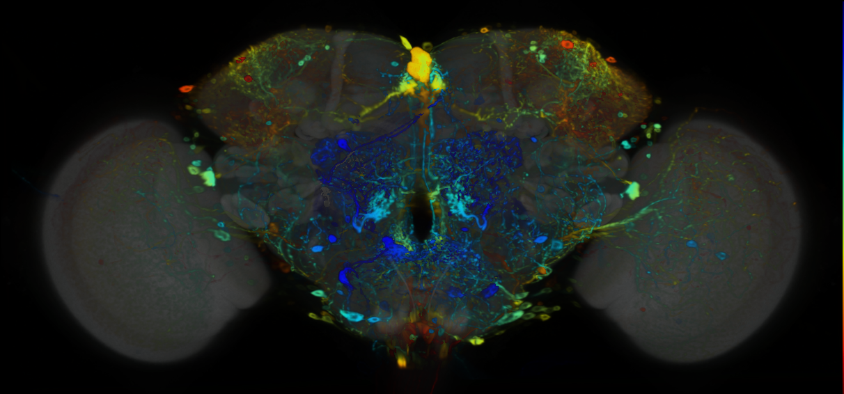 P{VT001426-GAL4} expression pattern