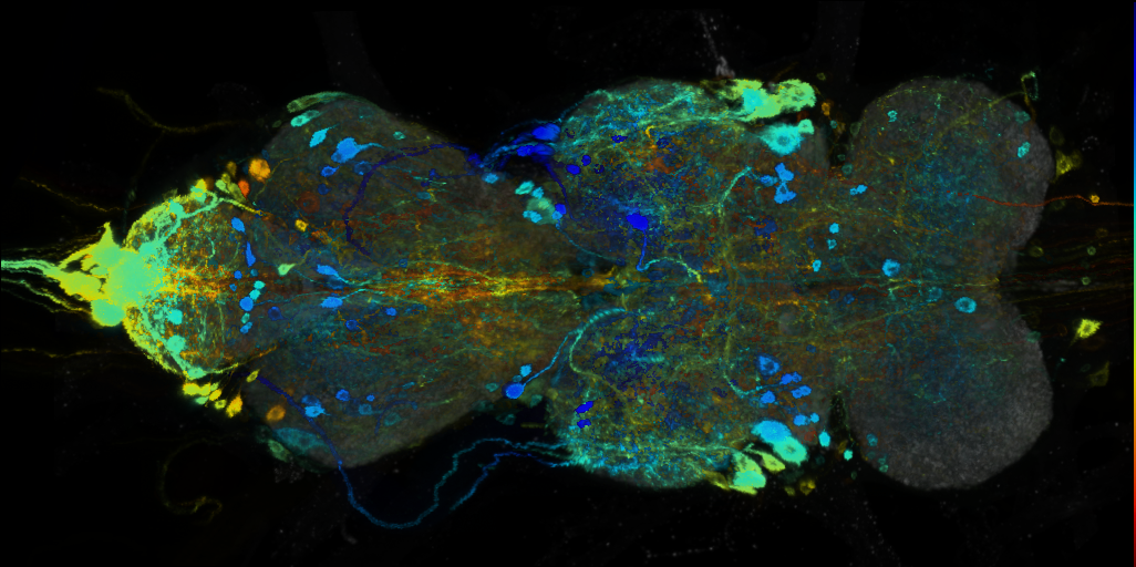 P{VT001426-GAL4} expression pattern