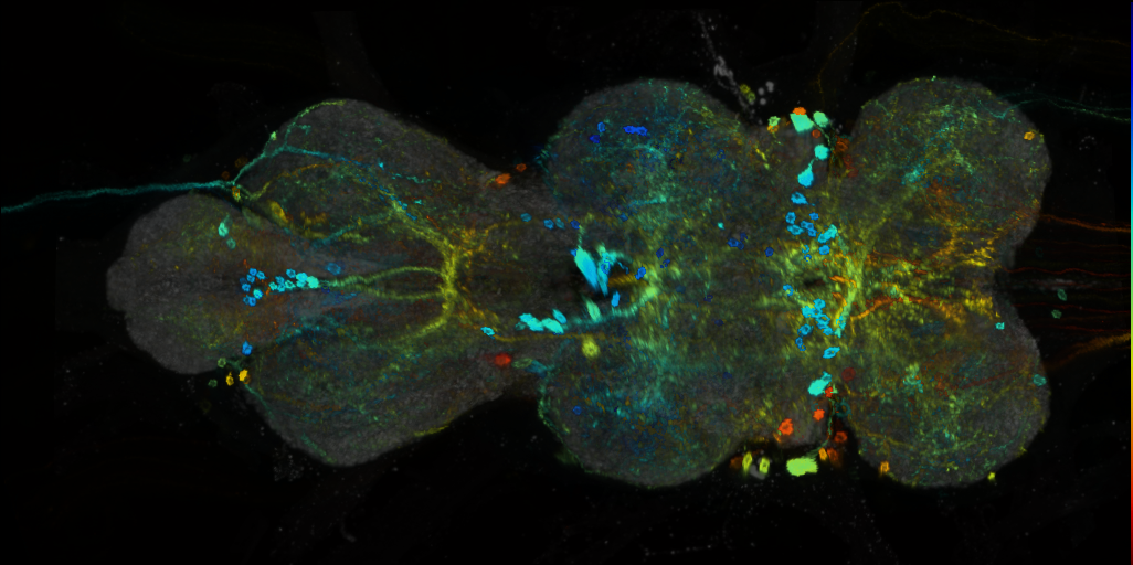 P{VT002408-GAL4} expression pattern