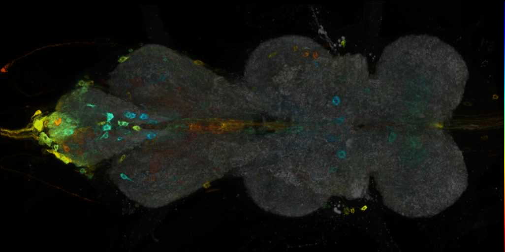 P{VT002471-GAL4} expression pattern