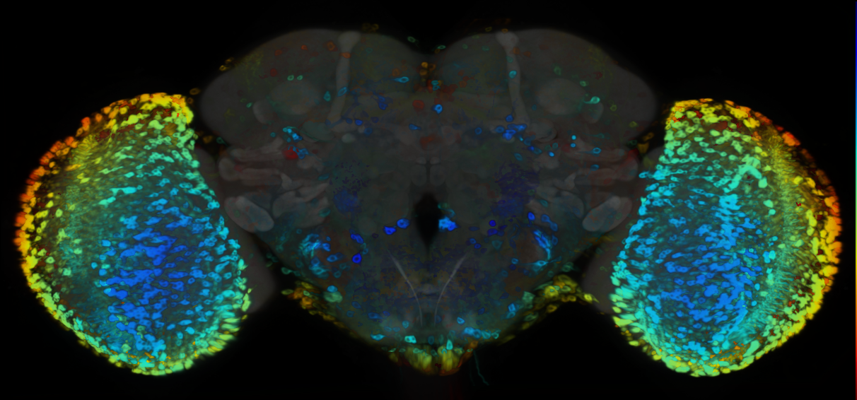 P{VT004425-GAL4} expression pattern