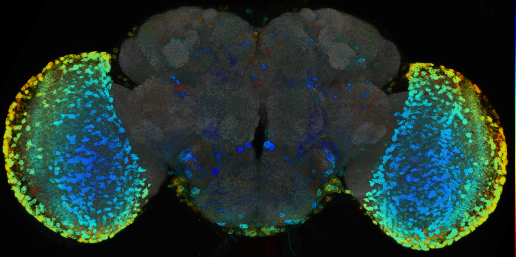 P{VT004425-GAL4} expression pattern