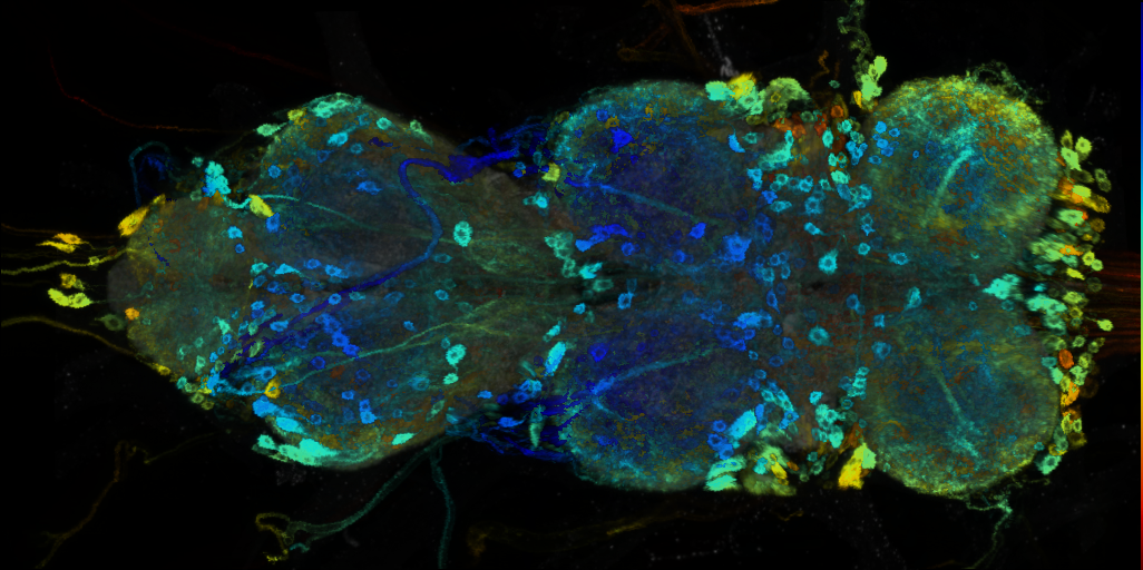 P{VT004425-GAL4} expression pattern