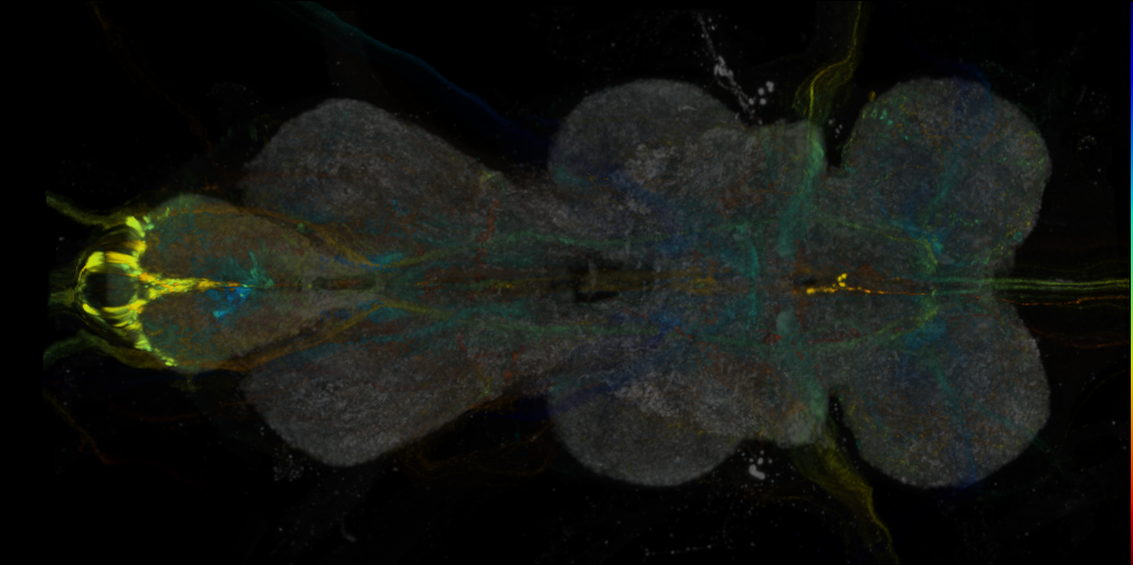 P{R54A05-GAL4.DBD} ∩ P{R26A03-p65.AD} expression pattern