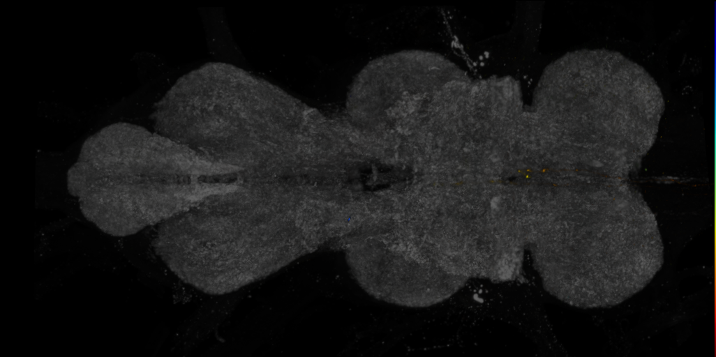 P{R54A05-GAL4.DBD} ∩ P{R26A03-p65.AD} expression pattern