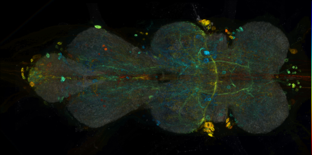 P{VT008881-GAL4} expression pattern