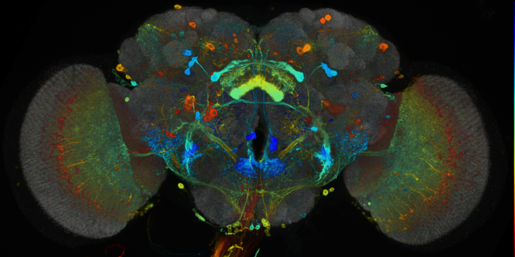 P{VT009835-GAL4} expression pattern