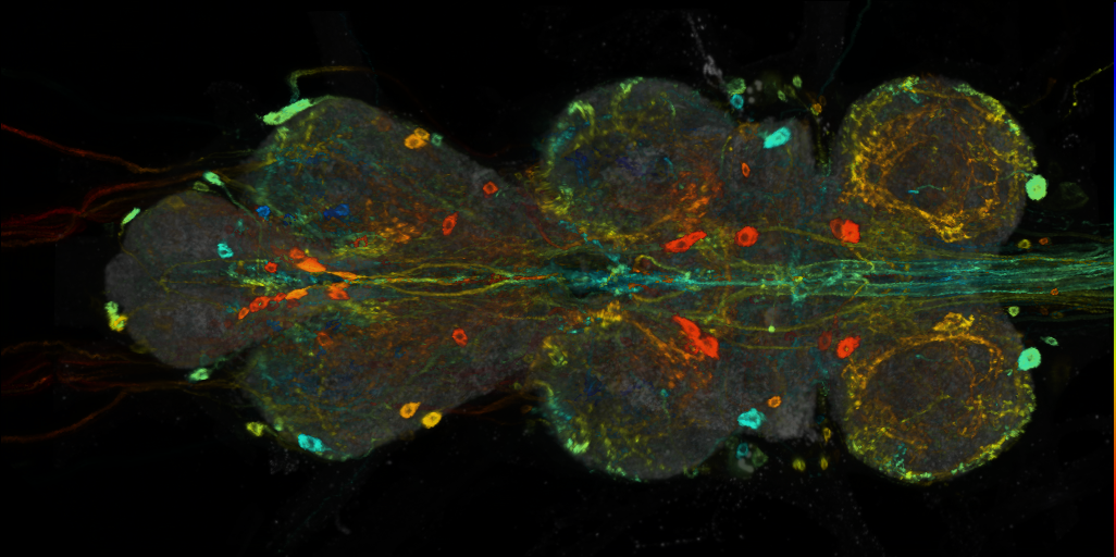 P{VT009835-GAL4} expression pattern