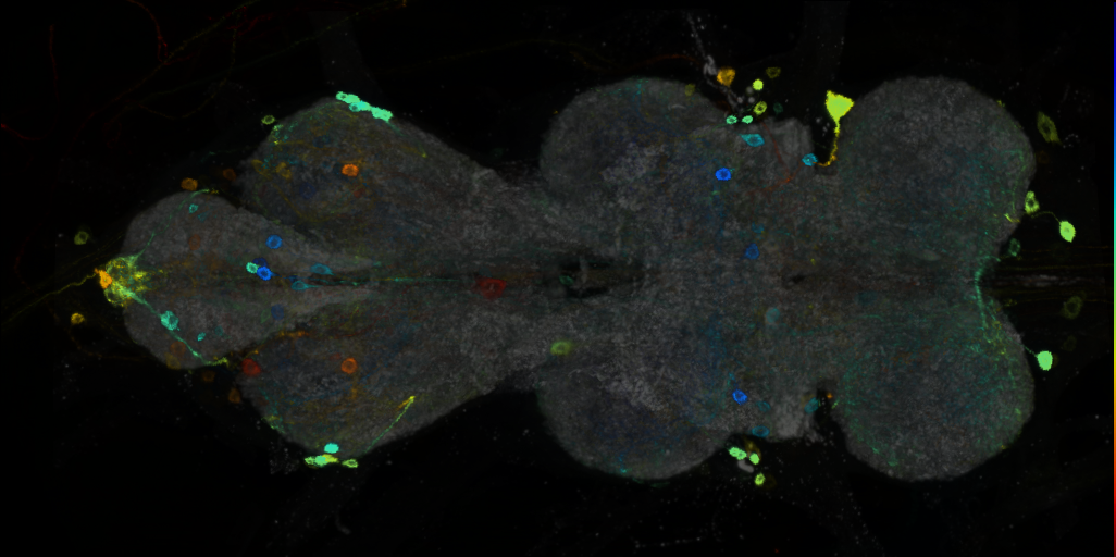 P{VT009855-GAL4} expression pattern