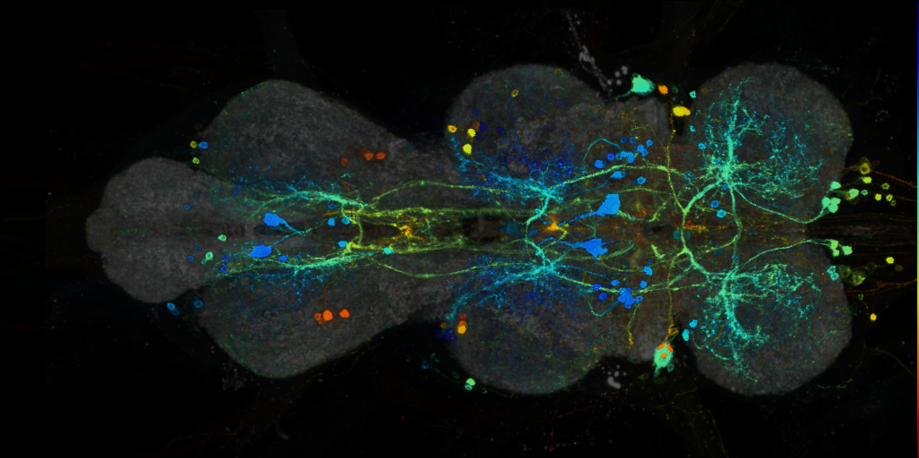 P{VT010055-GAL4} expression pattern