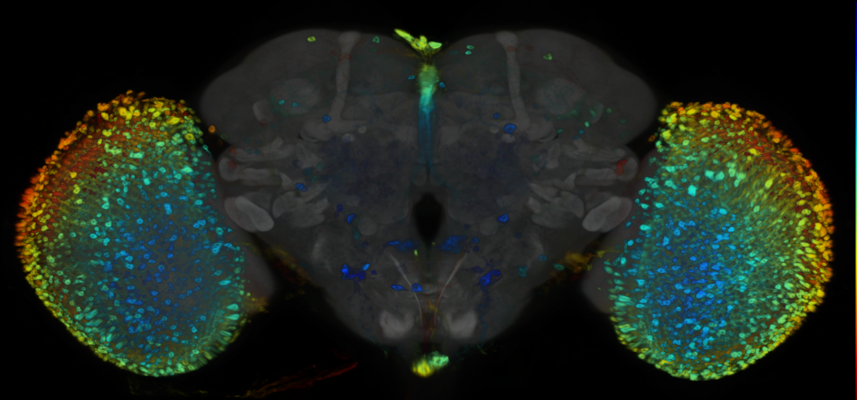 P{VT010571-GAL4} expression pattern