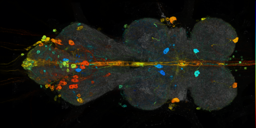 P{VT010571-GAL4} expression pattern