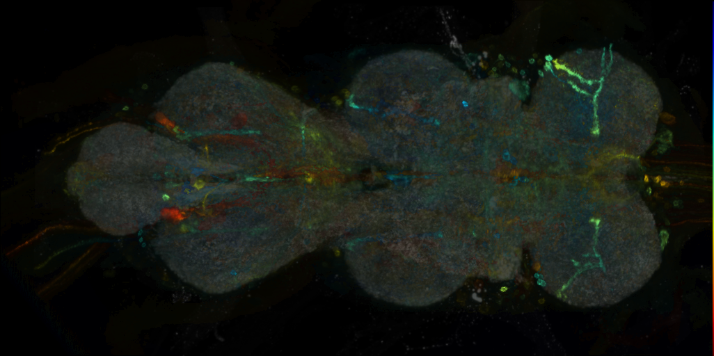 P{VT014966-GAL4} expression pattern