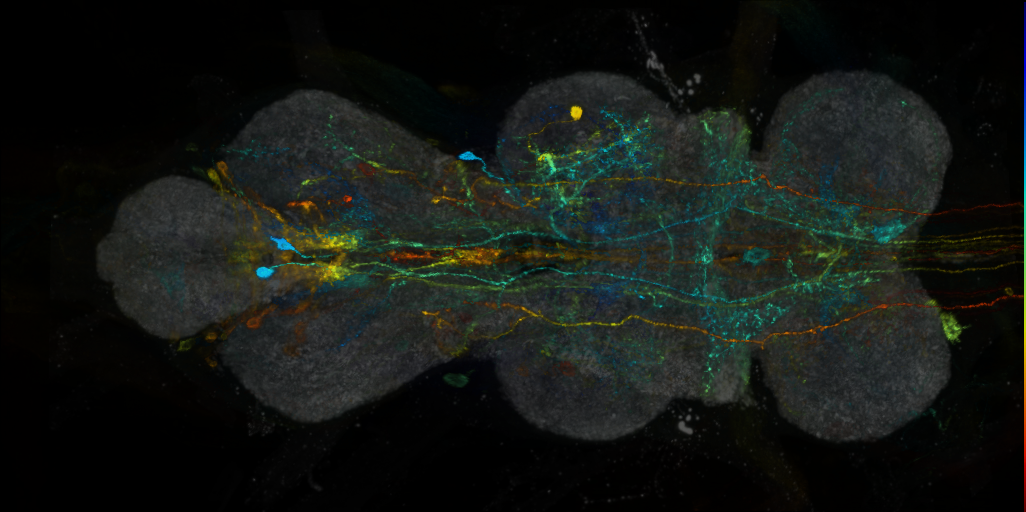 P{VT015434-GAL4} expression pattern