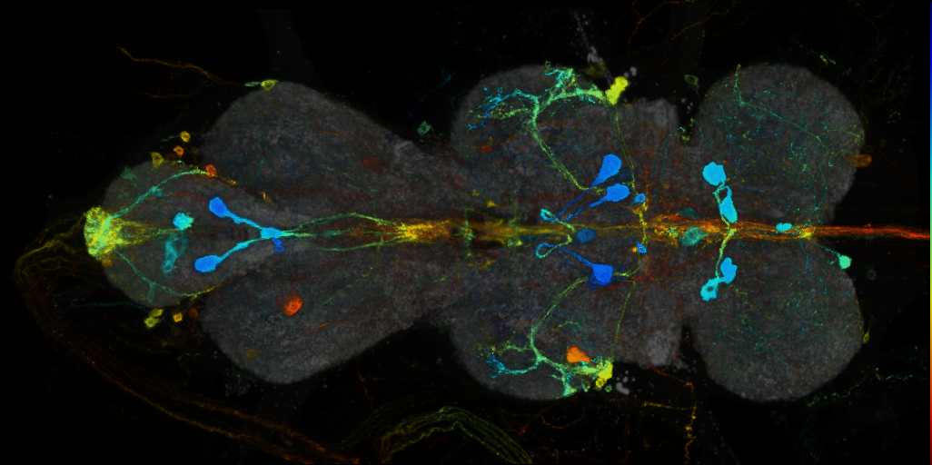 P{VT017001-GAL4} expression pattern