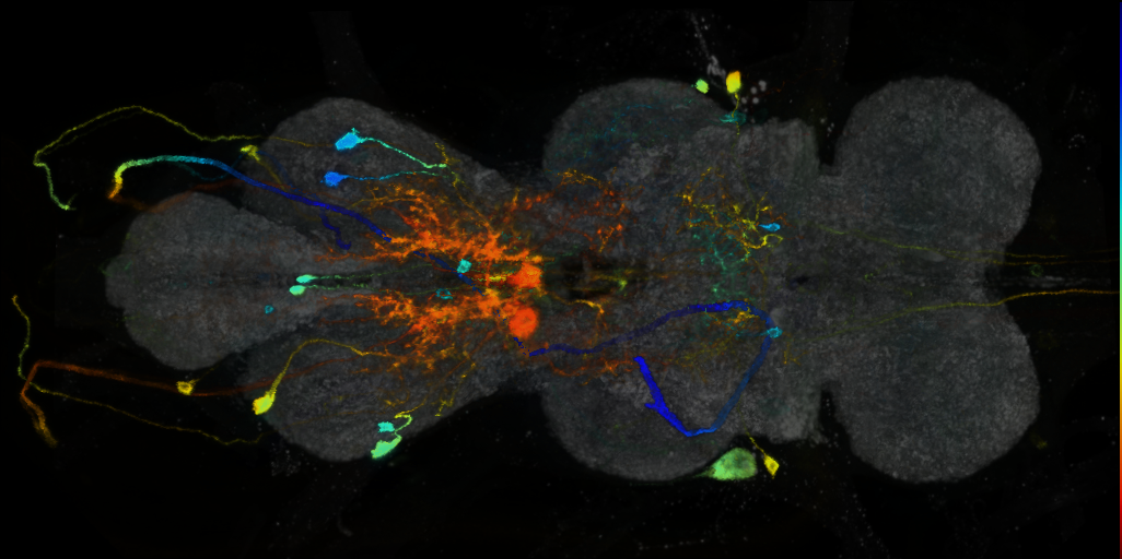 P{VT017191-GAL4} expression pattern