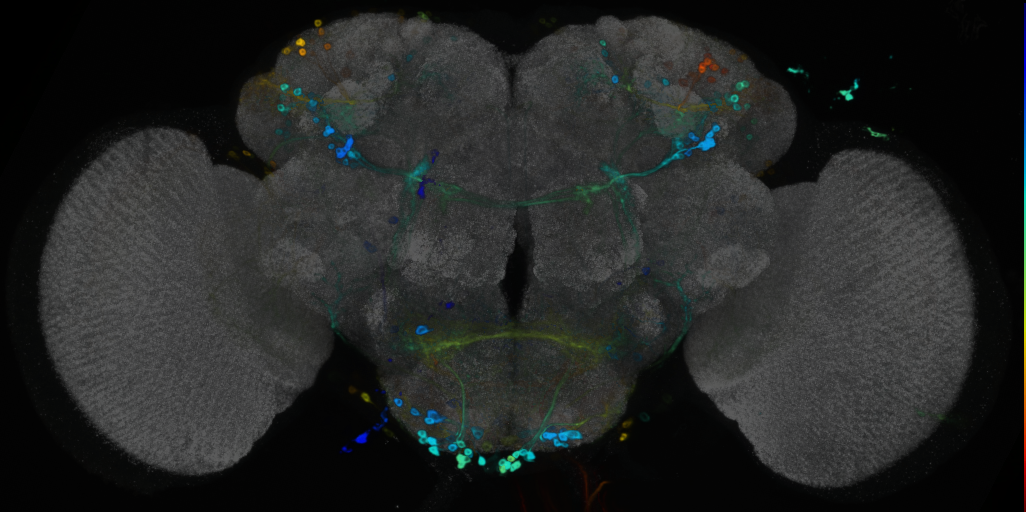 P{VT017240-GAL4} expression pattern