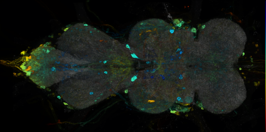 P{VT017240-GAL4} expression pattern